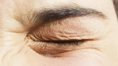 ارتعاش الجفن.. تعرف على أسباب حدوثه وطرق الوقاية منه