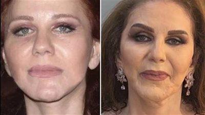 بعد تصدرها التريند.. حقيقة خضوع ميادة الحناوي لعمليات تجميل 