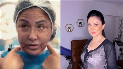 وفاء سالم تكشف تفاصيل مأساوية من عمليات التجميل الخاطئة 