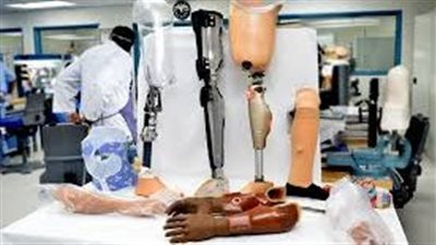 مركز الأطراف الصناعية يُقدم الخدمات الطبية لـ 504 مستفيد 