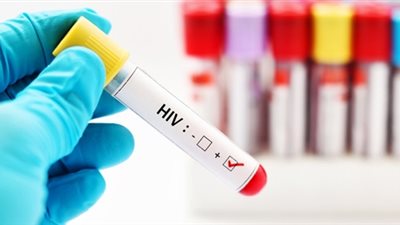 كل ما تريد معرفته عن مرض الإيدز