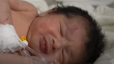 بعد ولادتها تحت الأنقاض.. محاولة لاختطاف الرضيعة عفراء (فيديو)