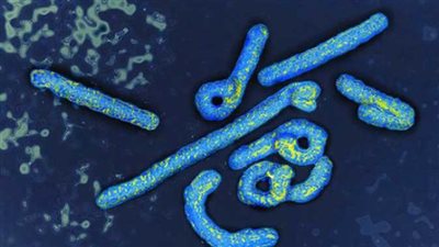 هل هناك حالات مصابة بفيروس ماربورج في مصر؟.. مستشار الرئيس يجيب