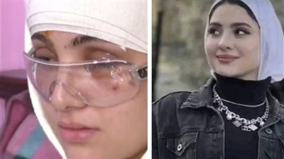 بعد تصدرها التريند.. القصة الكاملة لحادث البلوجر سارة محمد التي فقدت عينها