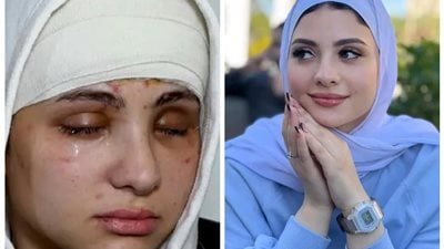 البلوجر سارة محمد.. أول ظهور لها الليلة بعد فقدانها البصر