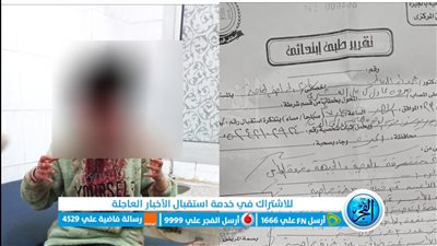 25 غرزة.. ننشر التقرير الطبي لضحية الاعتداء على يد شاب وتشويه وجهها بالوراق
