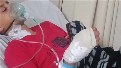 إصابة طالب ثانوي بجرح نافذ لرفضه مساعدة آخر على الغش بالدقهلية