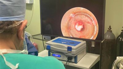 إنقاذ حياة طفل ابتلع 