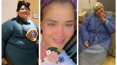 «من غير ذكاء اصطناعي».. إسراء محي تخسر 157 كيلو: «كنت بموت» (صور)