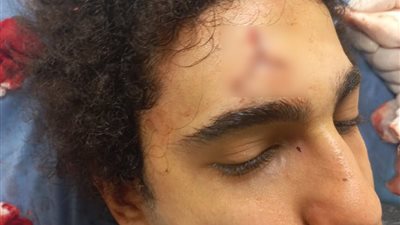 حبس المتهمين بتهشيم رأس لاعب ببورسعيد 5 سنوات