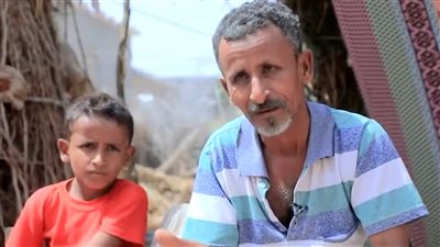 أحمد سالم صلاهم.. طفل يمني فقد جنة طفولته على يد الألغام الحوثية وتحولت حياته لجحيم