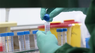 لماذا أرعب متحور كورونا EG.5 العالم؟.. مختصون لـ 