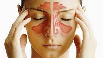 5 نصائح لعلاج الصداع في نصف ساعة 