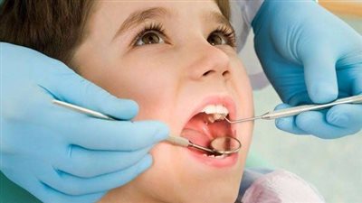  التهاب اللثة عند الأطفال.. الأسباب وطرق علاجها 