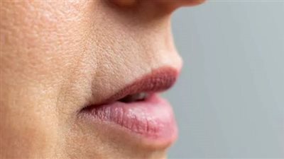 10 طرق لإزالة السواد حول الفم.. تعرفي عليها