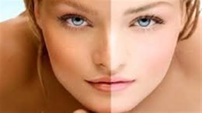 طرق لتفتيح البشرة المتسمرة بسبب الشمس