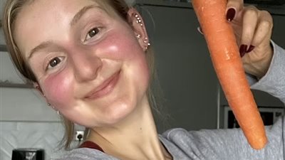 «تأكل 10 حبات من الجزر يوميا».. عشرينية تروي المخاطر الصحية التي تعرضت لها