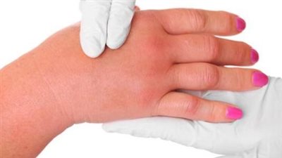 طرق التخلص من الأملاح الزائدة في الجسم 