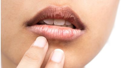 تجنُب التدخين وتقليل الكافيين.. 8 نصائح لمعالجة السواد حول الفم