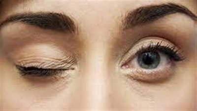 تعرف على أسباب رفة العين وطرق الوقاية