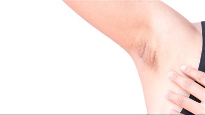 اسمرار الإبط.. نصائح فعّالة للحفاظ على لون الإبطين