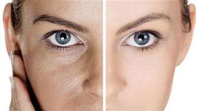 أفضل الحلول لتوحيد لون البشرة.. وصفات وطرق سحرية