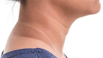 سواد الرقبة.. وصفات طبيعية فعّالة لتحسين لون الجلد