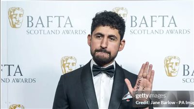 أمير المصري يدعو لوقف إطلاق النار في غزة في حفل بافتا اسكتلندا