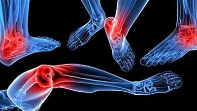 أضرار الكعب العالي: حدث ولا حرج