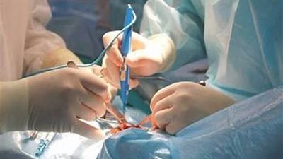 جراحة الأوعية الدموية.. اسبابها وانواعها ومخاطرها