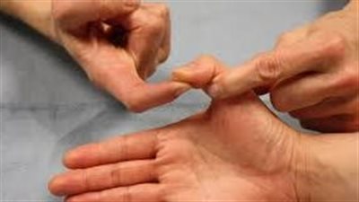 علاج آلام اصابع اليد..توصيات للحد من مشاكل المفاصل في أصابع اليد