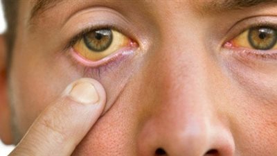 حماية عينيك: الخطوات الأساسية للعناية بصحة العيون