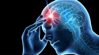  الصداع النصفي.. تعرف على اسبابة وأعراضة