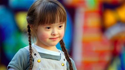  متلازمة داون: فهم وتعامل فعّال 