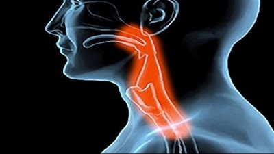 صعوبة البلع: الأسباب والعلاج