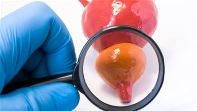 تقنيات متقدمة في علاج أمراض البروستاتا: تحولات الرعاية الطبية وآفاق المستقبل