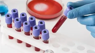 تحليل خلايا الدم الحمراء (RBC): فهم أعماق الصحة الدموية