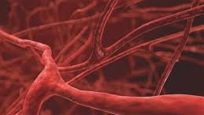 التهاب الشرايين تاكاياسو..مرض نادر يصيب النساء الشابات