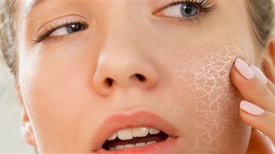 10 نصائح للوقاية من جفاف البشرة في فصل الشتاء