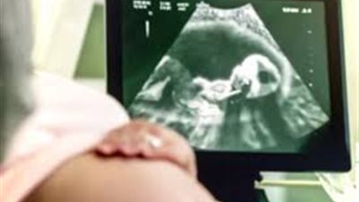 فحص أعضاء الجنين.. ما هو وكيف يتم؟