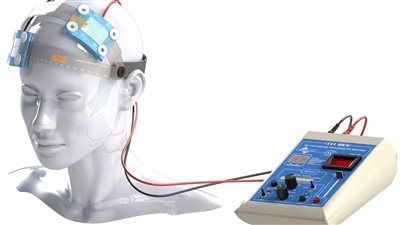 تقنيات التحفيز العصبي: فتح آفاق جديدة لعلاج اضطرابات الدماغ