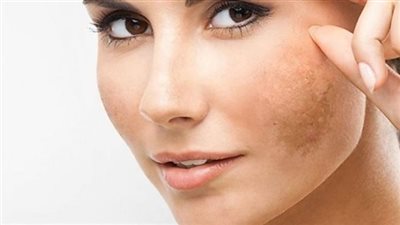  استعادة نضارة البشرة: طرق متنوعة لعلاج اكسدة البشرة