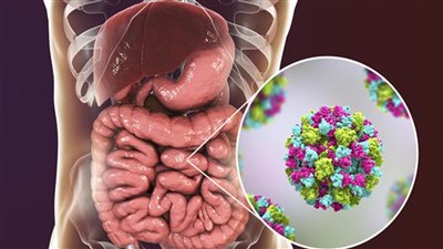 تعرف على أسباب النزلة المعوية