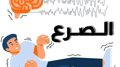 كل ما تريد معرفته عن أعراض الإصابة بمرض الصرع