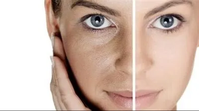 كولاجين البشرة.. بين الفوائد والمخاطر - استكشاف الآثار الجانبية المحتملة لاستخدام الكولاجين للعناية بالبشرة