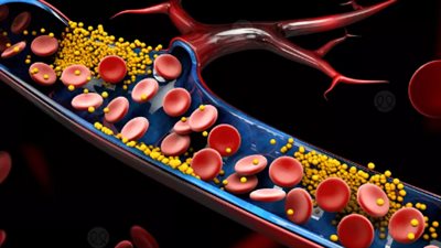 احذر أعراض ارتفاع الكولسترول.. تتحول لـ مرض مميت