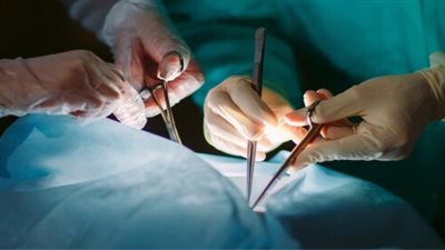 ما عقوبة نقل الأعضاء من جسم الإنسان دون ثبوت موته؟