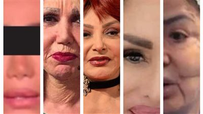 وجه عابس وتشوهات مدي الحياة آخرهم ريهام سعيد.. فنانين تعرضوا لعمليات تجميل فاشلة 