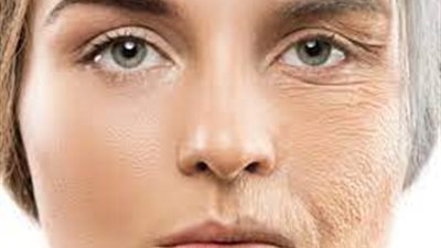 ما أسباب ظهور التجاعيد المبكرة بين الشباب؟.. وكيفية الوقاية؟