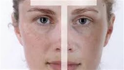 نصائح للعناية بالبشرة المختلطة والحصول علي بشرة صحية ونظيفة 